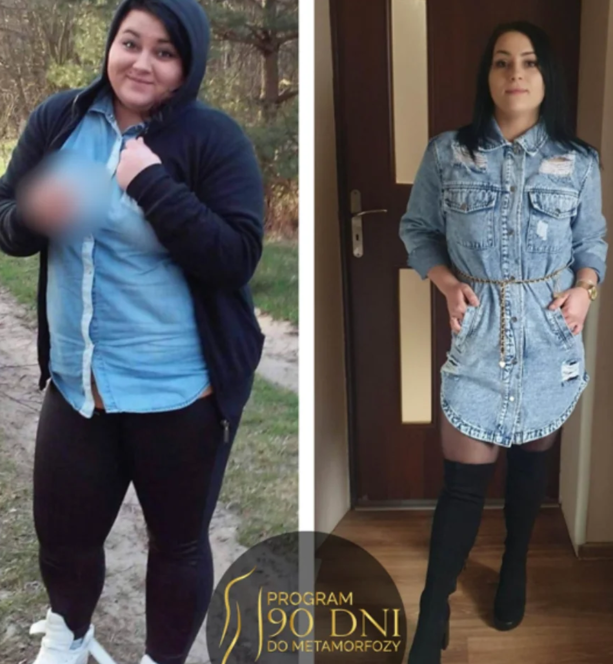 Transformacja pacjentki Dominiki